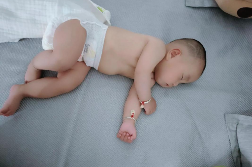 范县宝宝脸上有白色斑块